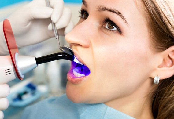 woman getting dental bonding 