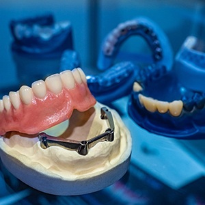 implant dentures on table