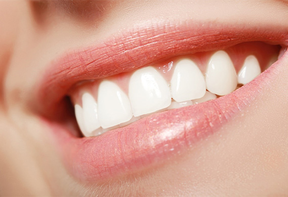 Close-up of attractive, healthy smile after gum contouring procedure