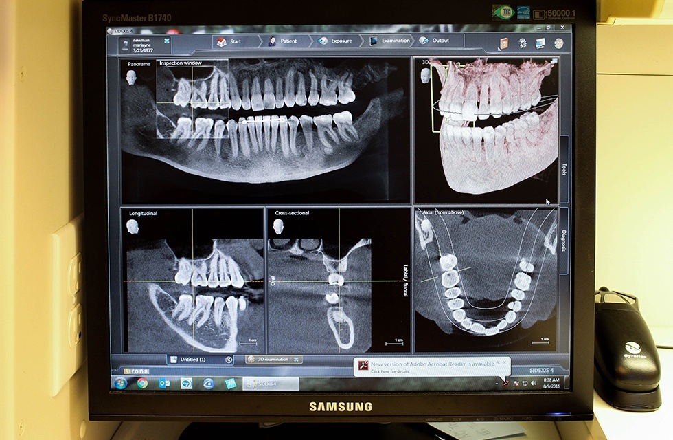 x-rays on computer