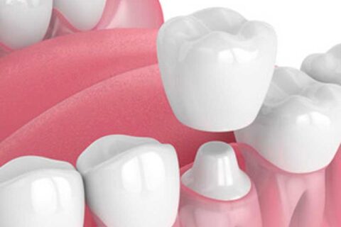 Teeth animation